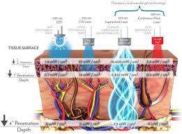 theralase_pic2